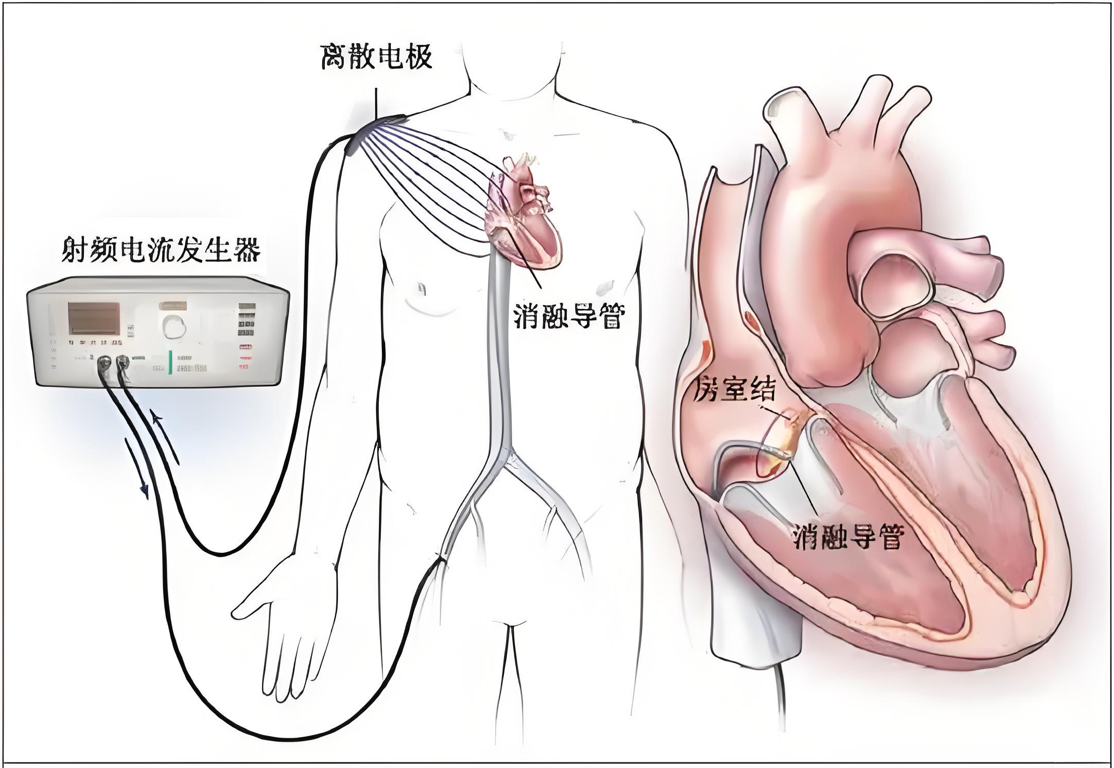 图片12.png