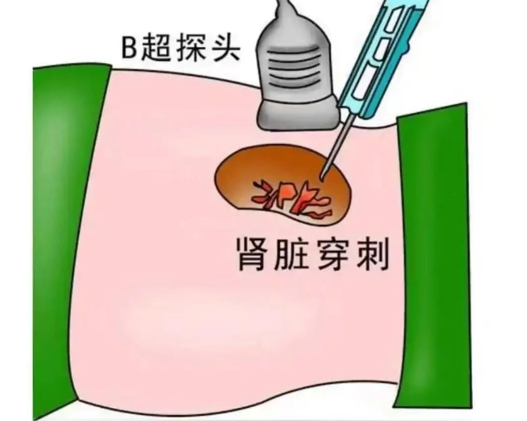 图片23.png