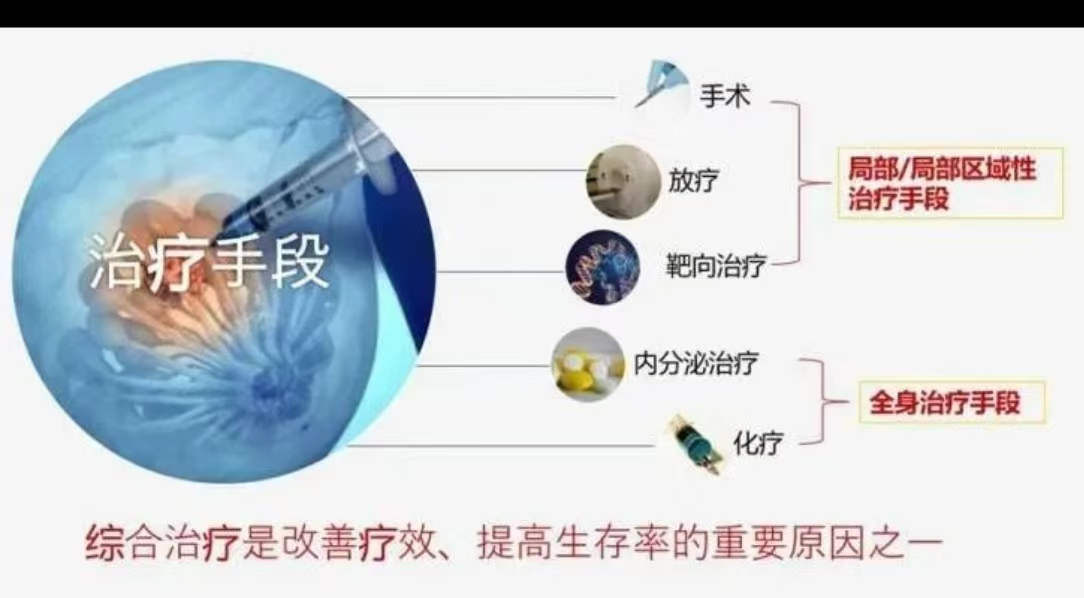 乳腺癌综合治疗.png