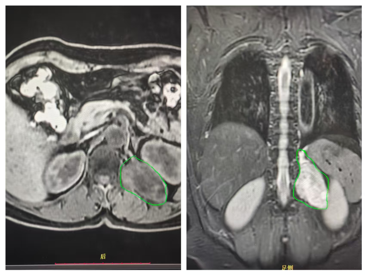 微信图片_2026-01-06_150809_391.png 微信图片_2026-01-06_150809_391.png